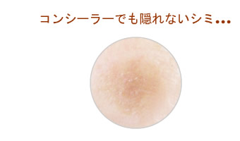 コンシーラーでも隠れないシミ
